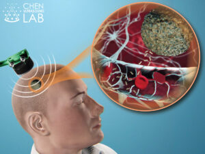 illustration of a person with inset of the inside of the brain