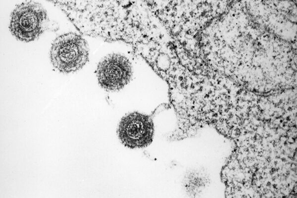 New way viruses trigger autoimmunity discovered