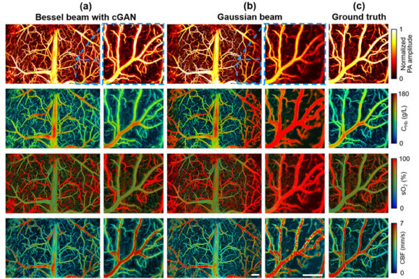 A one-two punch for photoacoustic imaging