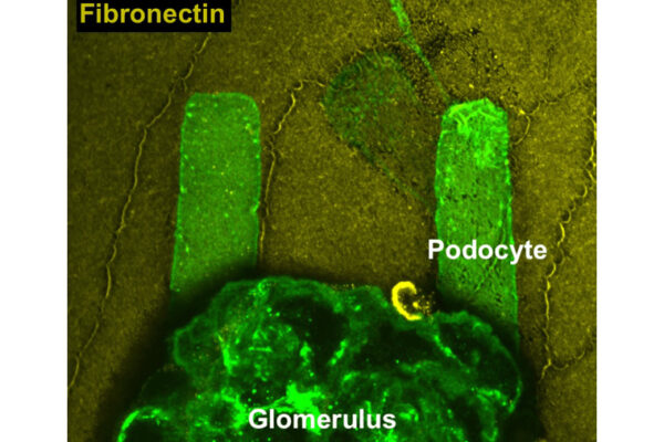 New technology offers pathways to finding treatments for kidney disease