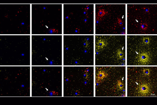 ‘Simple yet powerful’: Seeing cell secretion like never before