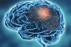 brain illustration