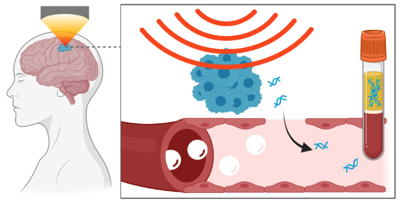 focused-ultrasound-mediated liquid biopsy