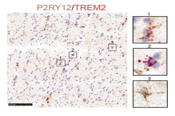 Zhao studies changes in glia linked to  neurodegenerative diseases