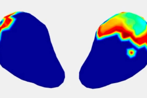 Imaging tech produces real-time 3D maps of uterine contractions during labor