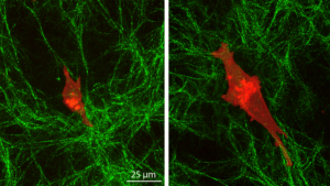 cancer cells