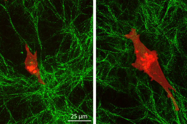 Cancer cells penetrate deep into their environment