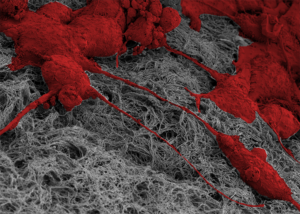 human mammary epithelial cells