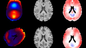 brain images