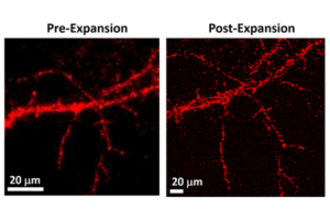 neurons