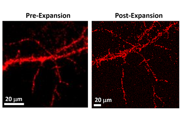 Brighter fluorescent markers allow for finer imaging