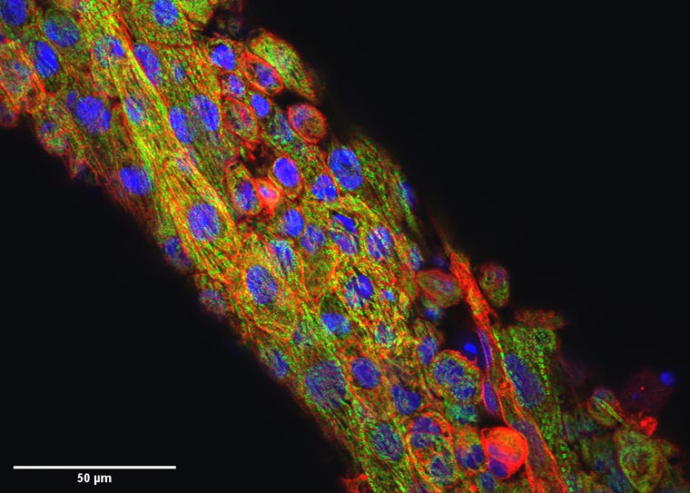 仮想薬剤が心臓組織画像のノイズを静める(Virtual drug quiets noise in heart tissue images)