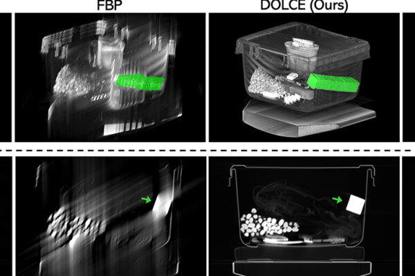 Meet DOLCE, an AI tool that reconstructs CT images from limited-view data