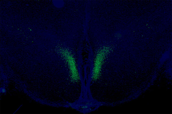 Life span increases in mice when specific brain cells are activated