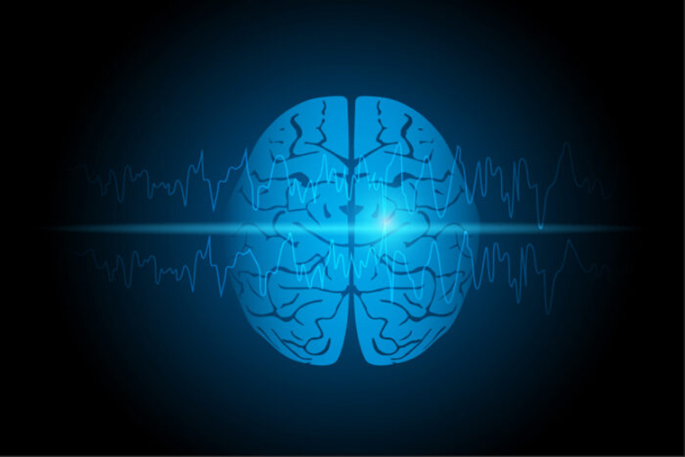 Illustration of focal seizure and human brain