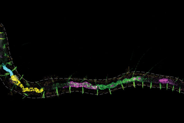 Unlocking the ‘chain of worms’