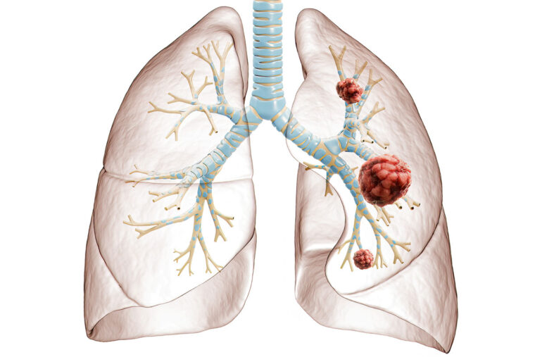 human lungs