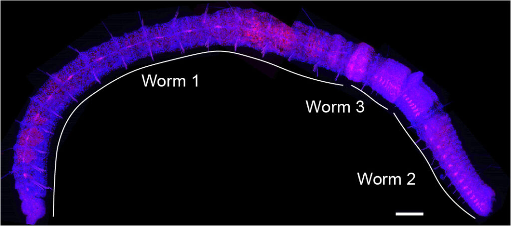 Unlocking the 'chain of worms' - The Source - WashU