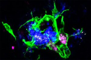 APOE proteins and microglia cells