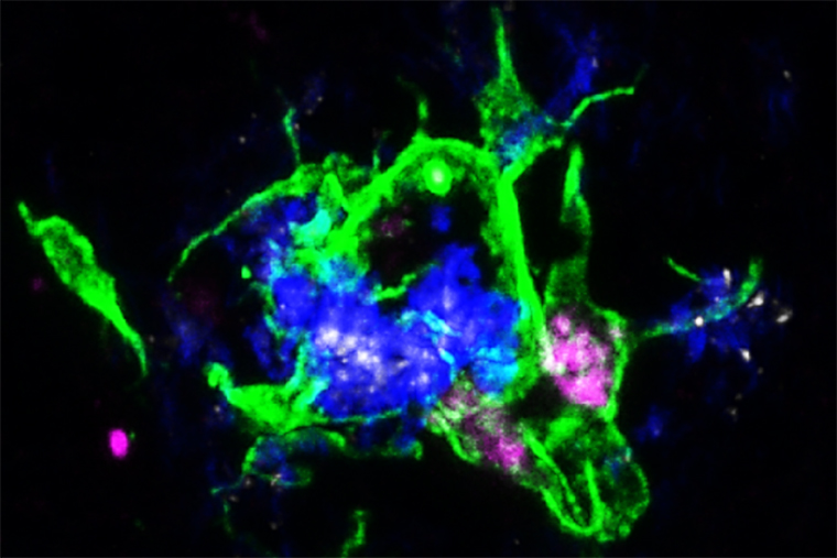 APOE proteins and microglia cells