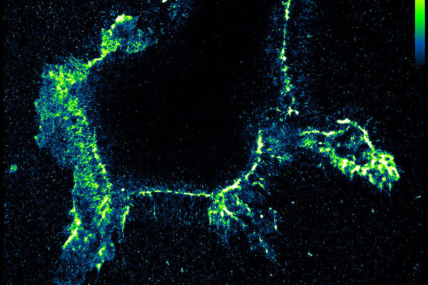 Chemists develop test to track crucial edits to RNA