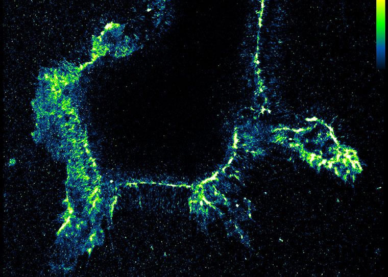 edited RNA