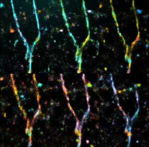 amyloid beta (Aβ42) fibrils undergoing remodeling