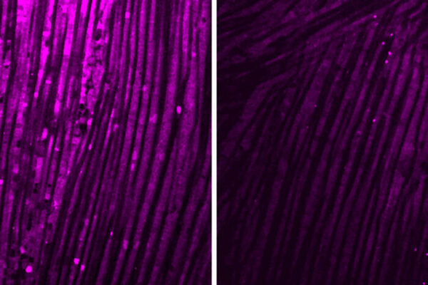 Brain inflammation triggers muscle weakness after infections