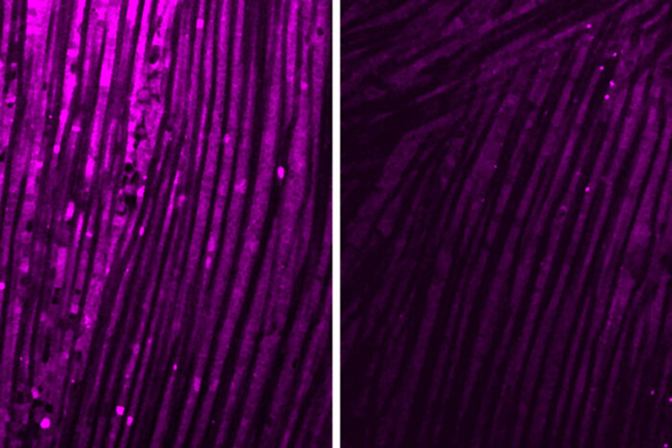 fruit fly muscles