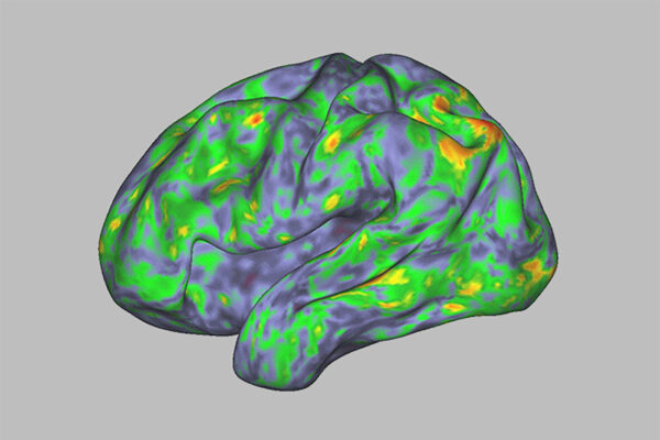 Psilocybin generates psychedelic experience by disrupting brain network