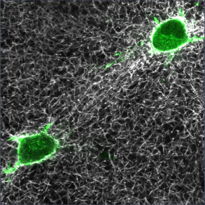 An image of two cells stained green to show cell communication