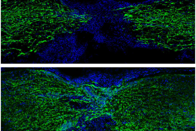 cells in the spinal cord of a zebrafish