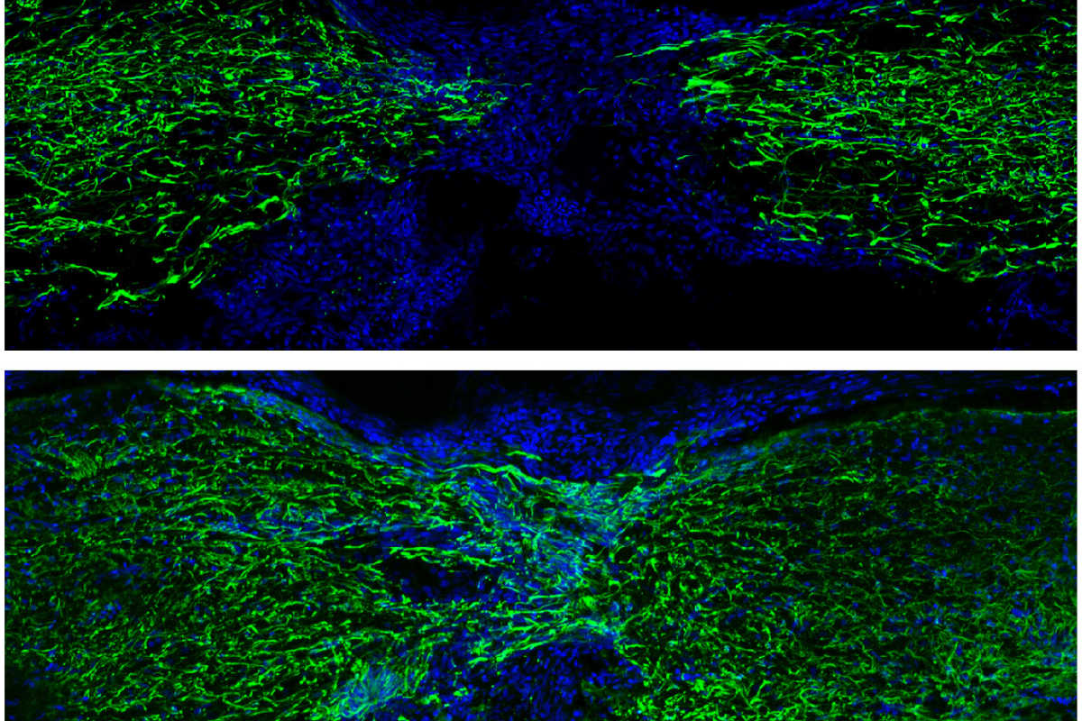 Zebrafish use surprising strategy to regrow spinal cord