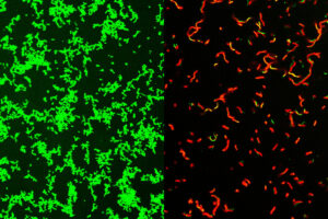 Streptococcus pyogenes bacteria