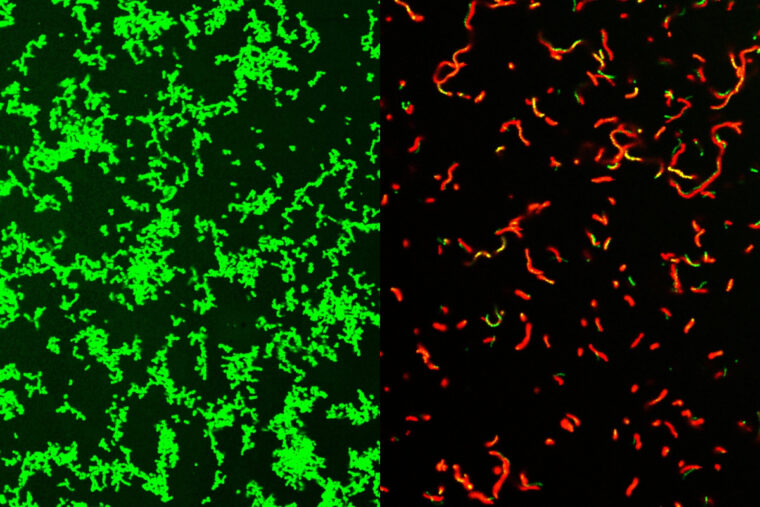 Streptococcus pyogenes bacteria