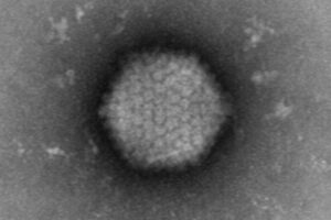 virus delivery system for cystric fibrosis therapy