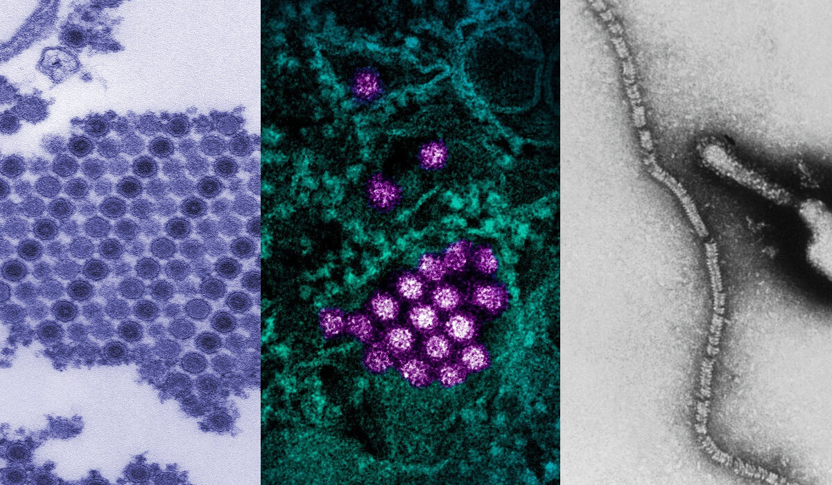 chikungunya, dengue and parainfluenza viruses