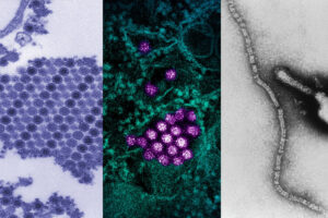 chikungunya, dengue and parainfluenza viruses
