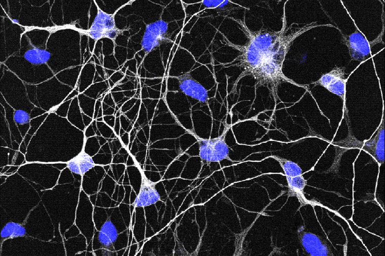 Neurons reprogrammed from the skin cells