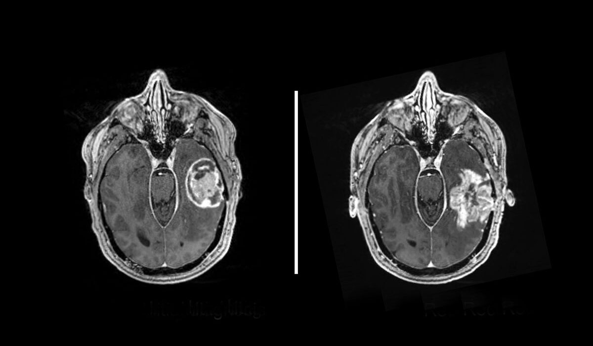 brain scans