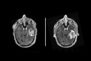 brain scans