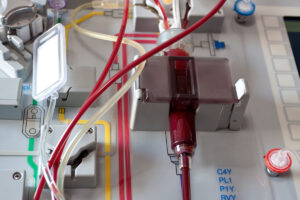 stem cell transplantation device