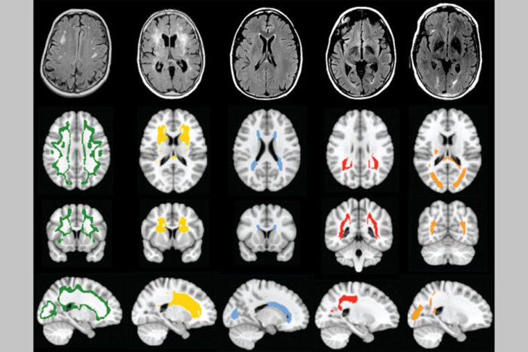 Brain scans