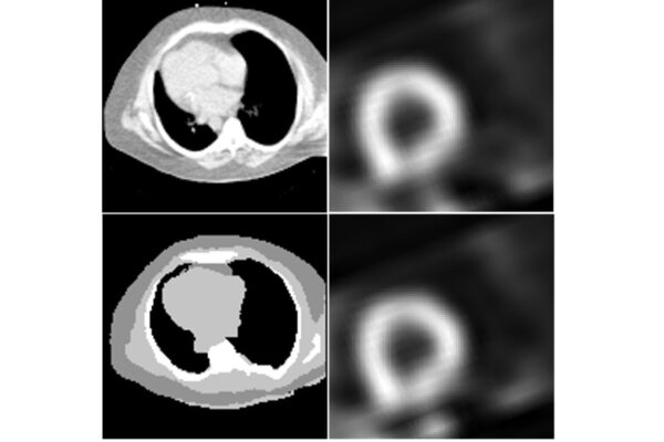 Deep learning to increase accessibility, ease of heart imaging