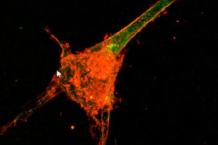 microtubule in action