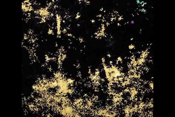 Overlooked cell type orchestrates brain rewiring