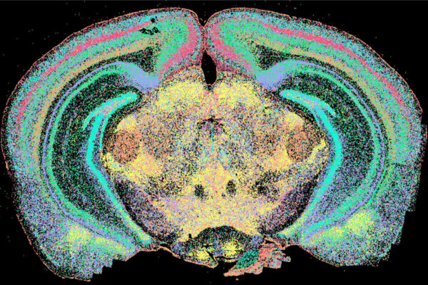 $12 million grant funds studies of role of genes in autism, similar diagnoses