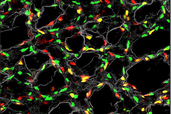 Ornitz receives NIH grant to study lung development 
