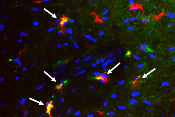 Cells from the spleen play surprising role after heart attack
