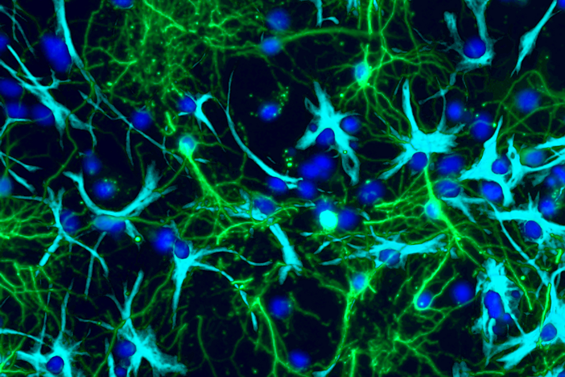 Study sheds light on how pediatric brain tumors grow